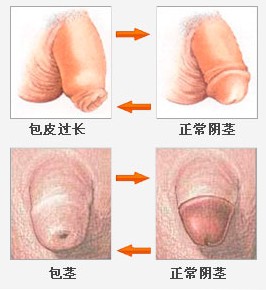 包皮
