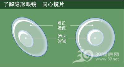 n类隐形眼睛 如何保养