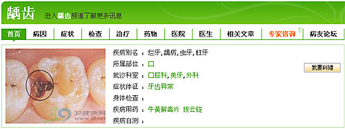 经常塞牙?下一步就是龋齿