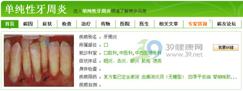 刷牙别把牙齿“锯断”了