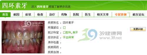 洗牙=美白?