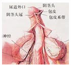 阴茎延长