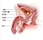 阴茎增粗