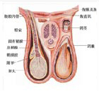 梅毒