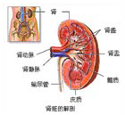 前列腺结石